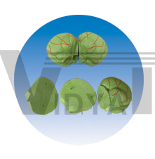 The expansion model of cerebellum